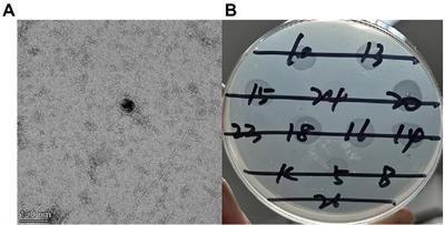 Topically applied bacteriophage to control multi-drug resistant Pseudomonas aeruginosa-infected wounds in a New Zealand rabbit model